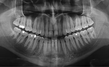 Kurzfilm: Dust | Manche Märchen haben einen wahren Kern