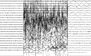 Heute gelernt: Wie es um einen rum bei einem Erdbeben aussieht
